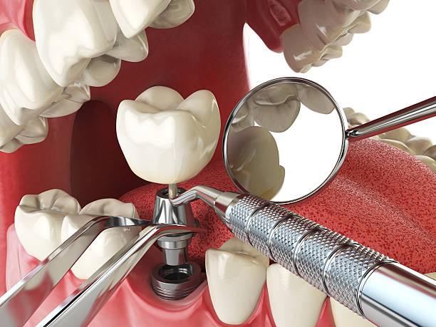 Best Broken Tooth Emergency  in Port Royal, SC