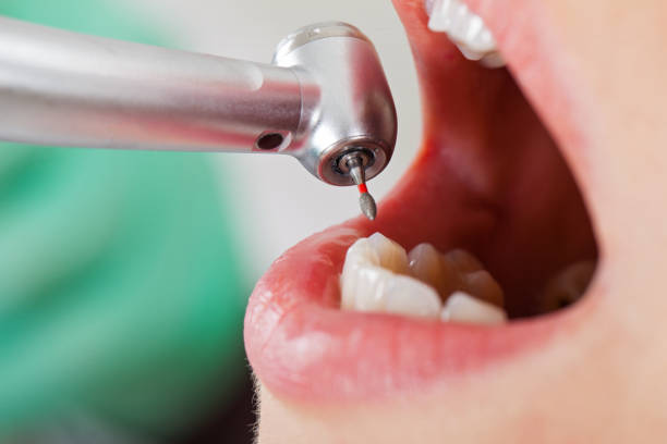 Best Emergency Tooth Extraction  in Port Royal, SC